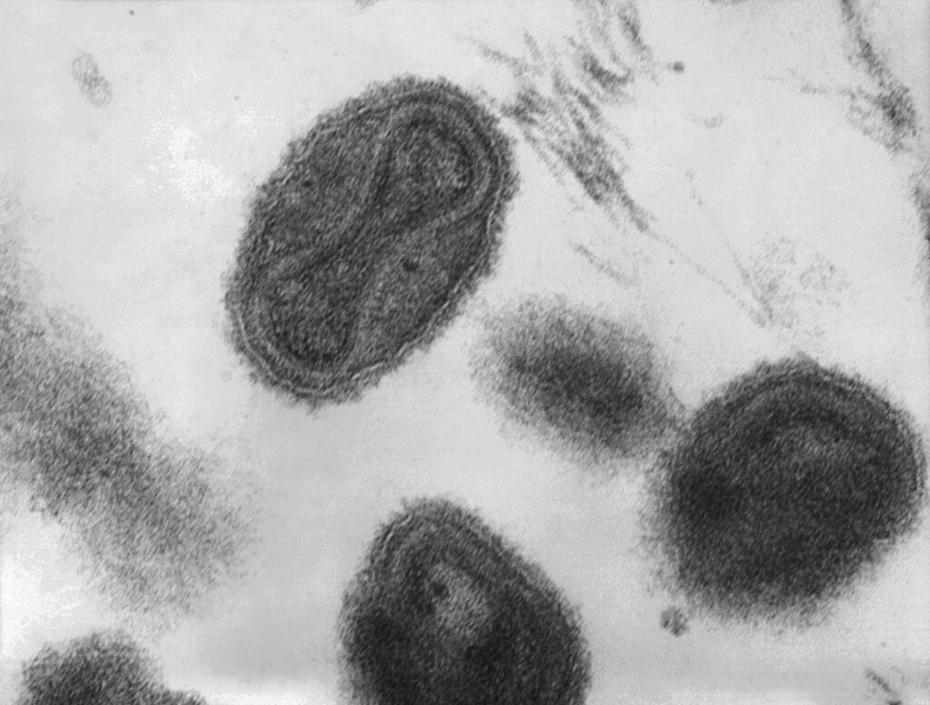 The smallpox virus under a microscope